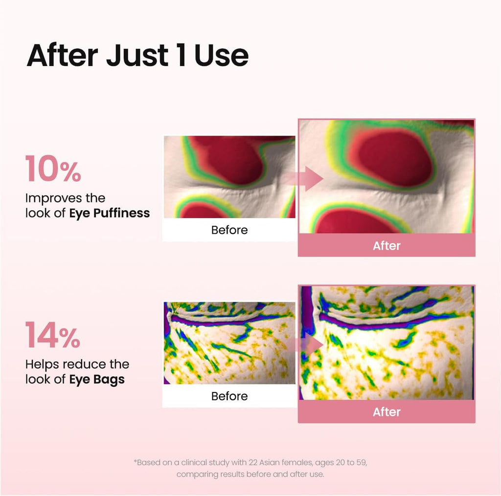 BIODANCE Collagen Peptide under Eye Patches 60 Counts. Advanced Hydrogel Eye Patches for Dark Circles & Puffy Eyes. under Eye Mask for Fine Lines. Eye Bags & Wrinkles. Korean Skincare.