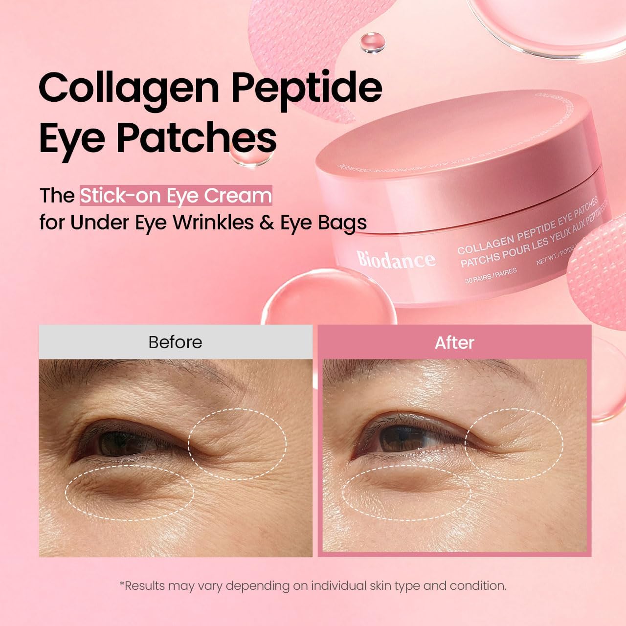 BIODANCE Collagen Peptide under Eye Patches 60 Counts. Advanced Hydrogel Eye Patches for Dark Circles & Puffy Eyes. under Eye Mask for Fine Lines. Eye Bags & Wrinkles. Korean Skincare.